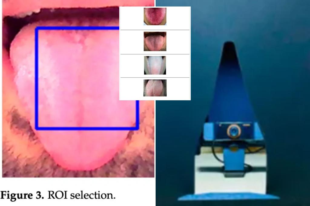 AI model 98% accurate in detecting diseases - just by looking at your tongue